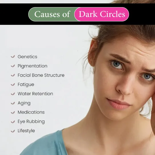 causes of dark circles