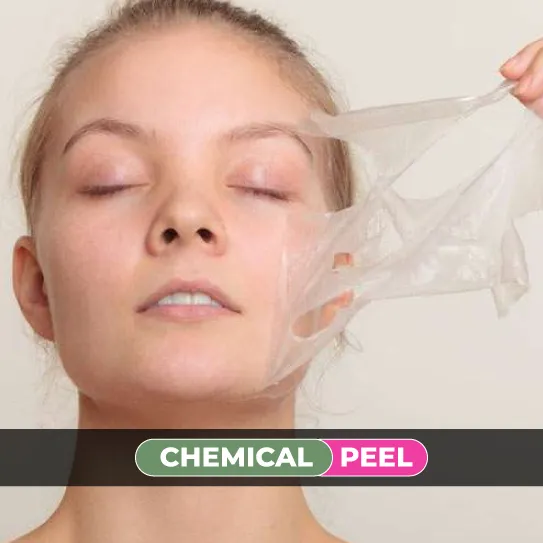 Chemical Peel