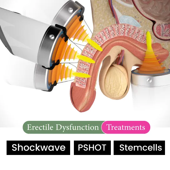 erectile dysfunction treatment