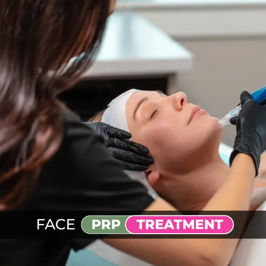 face prp treatment