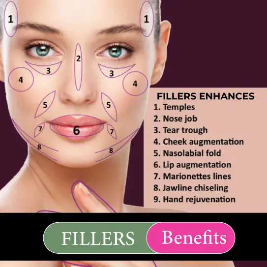 fillers benefits