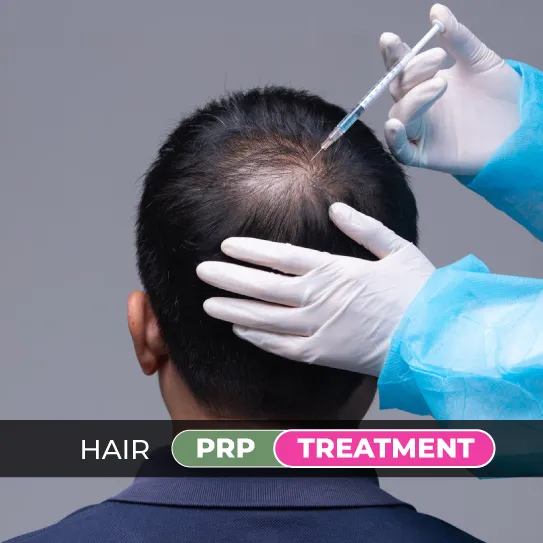 hair prp treatment