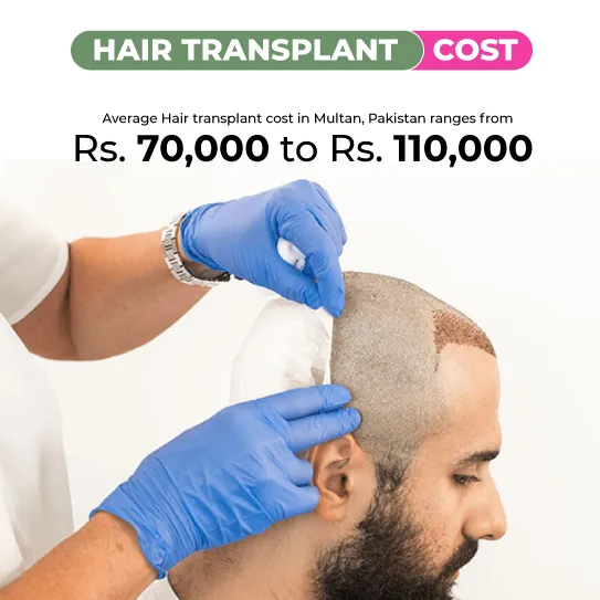 hair transplant cost