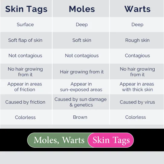 moles, warts, skin tags difference and causes