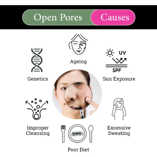 open pores causes