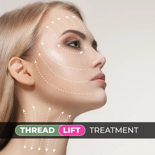 thread lift treatment