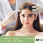 The Incredible Impact of Whitening Injections_ Before and After - Featured Image - Dot Clinic Pakistan