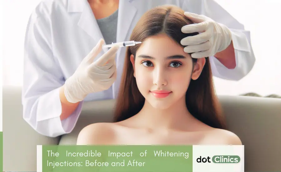 The Incredible Impact of Whitening Injections_ Before and After - Featured Image - Dot Clinic Pakistan