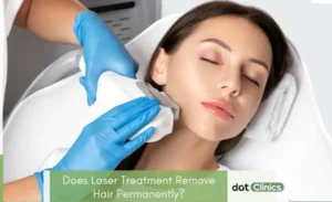 Does Laser Treatment Remove Hair Permanently - Featured Image - Dot Clinics Pakistan