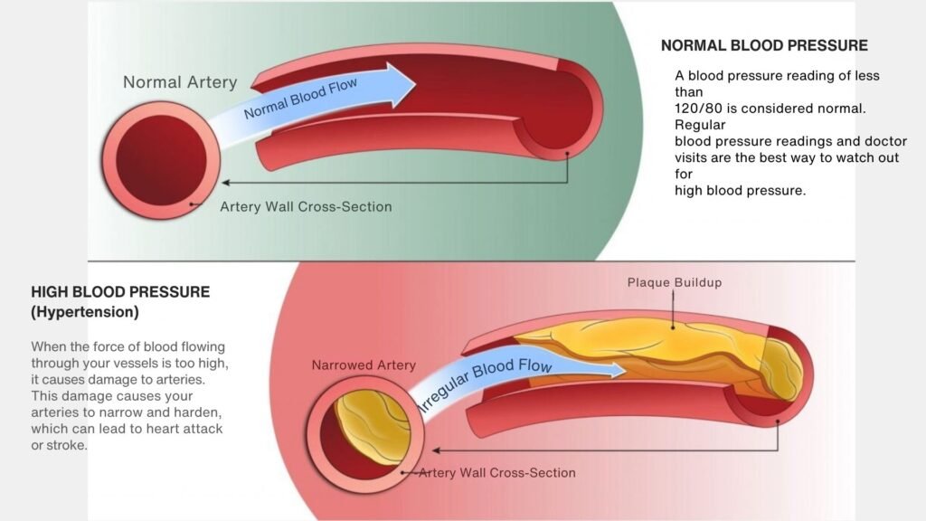 In Erectile dysfunction showing condition of normal and abnormal pressure of blood