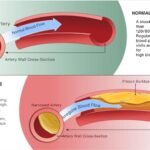 In Erectile dysfunction showing condition of normal and abnormal pressure of blood