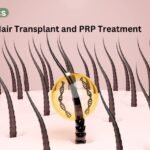 Hair grows faster with prp treatment and transplant gudance