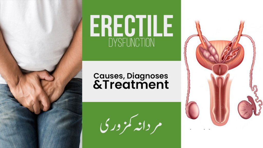 An informative graphic about erectile dysfunction. On the left, a man wearing a white shirt and jeans is sitting with his hands covering his groin area. The center has a green section with bold white and black text reading "ERECTILE DYSFUNCTION," "Causes, Diagnoses & Treatment," and the Urdu translation "مردانہ کمزوری." On the right, there's a detailed anatomical illustration of the male reproductive system.