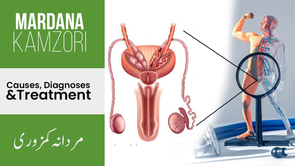 Illustration of male reproductive system with a focus on causes, diagnoses, and treatment of Mardana Kamzori. Includes anatomical diagram and a muscular figure with vascular highlights, emphasizing medical and natural solutions. Text in English and Urdu.